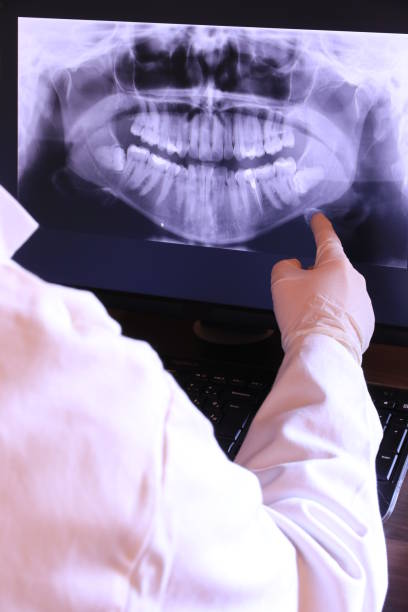 Best Emergency Dental Care for Sports Injuries in Stanleytown, VA
